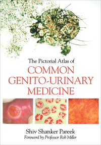 Cover image: The Pictorial Atlas of Common Genito-Urinary Medicine 1st edition 9781846194757