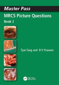 Cover image: MRCS Picture Questions 1st edition 9781846190544