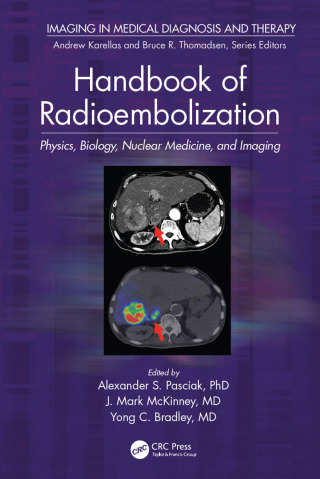 Imagen de portada: Handbook of Radioembolization 1st edition 9781498742016