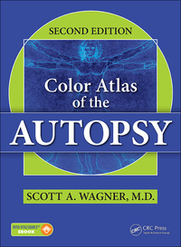 Titelbild: Color Atlas of the Autopsy 2nd edition 9781498734547