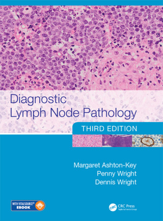 Imagen de portada: Diagnostic Lymph Node Pathology 3rd edition 9781498732697
