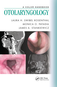Titelbild: Otolaryngology 1st edition 9781482253764