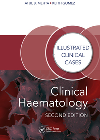 Titelbild: Clinical Haematology 2nd edition 9781482243796