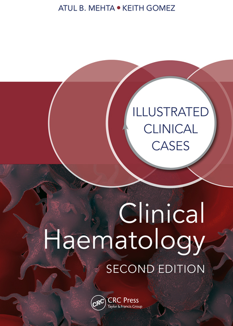 Clinical Haematology: Illustrated Clinical Cases, 2nd Edition - FULL INSTANT DOWNLOAD | PDF DOCX EPUB
