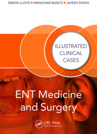 Titelbild: ENT Medicine and Surgery 1st edition 9781138091481