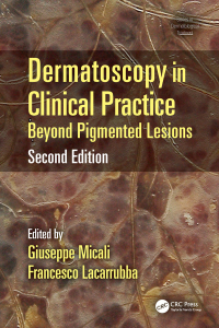 Imagen de portada: Dermatoscopy in Clinical Practice 2nd edition 9781482225952