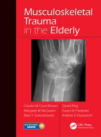 صورة الغلاف: Musculoskeletal Trauma in the Elderly 1st edition 9781482252026