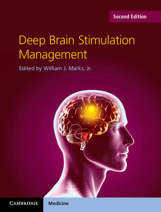 Imagen de portada: Deep Brain Stimulation Management 2nd edition 9781107084254