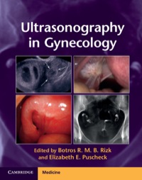 صورة الغلاف: Ultrasonography in Gynecology 1st edition 9781107029743