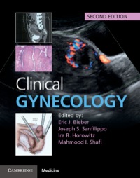 表紙画像: Clinical Gynecology 2nd edition 9781107040397