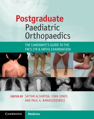 Cover image: Postgraduate Paediatric Orthopaedics 9781107644588