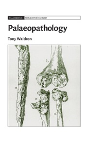 Titelbild: Palaeopathology 1st edition 9780521861373