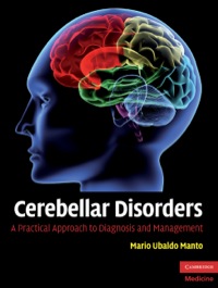 Cover image: Cerebellar Disorders 1st edition 9780521878135
