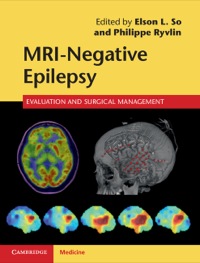 表紙画像: MRI-Negative Epilepsy 1st edition 9781107034235