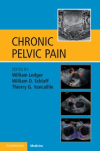 Titelbild: Chronic Pelvic Pain 1st edition 9781107636620