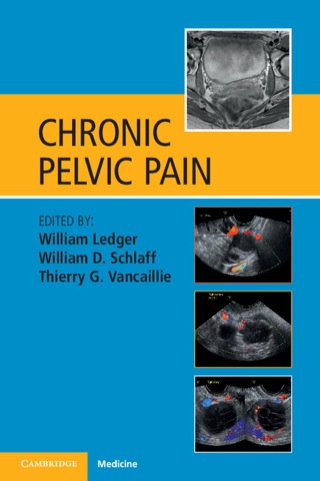 Cover image: Chronic Pelvic Pain 1st edition 9781107636620