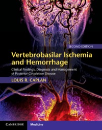 表紙画像: Vertebrobasilar Ischemia and Hemorrhage 2nd edition 9780521763066