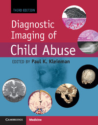 Cover image: Diagnostic Imaging of Child Abuse 3rd edition 9781107010536