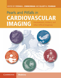 Imagen de portada: Pearls and Pitfalls in Cardiovascular Imaging 1st edition 9781107023727