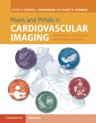 Immagine di copertina: Pearls and Pitfalls in Cardiovascular Imaging 1st edition 9781107023727
