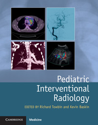 Cover image: Pediatric Interventional Radiology 1st edition 9781107042629