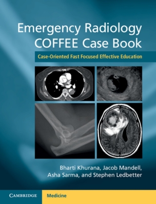 صورة الغلاف: Emergency Radiology COFFEE Case Book 9781107690769