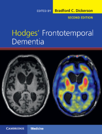 Omslagafbeelding: Hodges' Frontotemporal Dementia 2nd edition 9781107086630