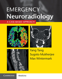 Cover image: Emergency Neuroradiology 1st edition 9781107676138