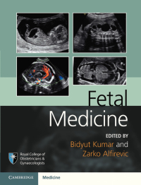 Cover image: Fetal Medicine 9781107064348