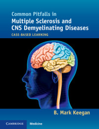 Imagen de portada: Common Pitfalls in Multiple Sclerosis and CNS Demyelinating Diseases 9781107680401