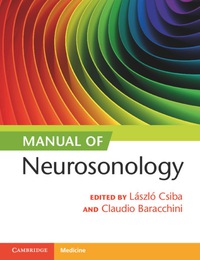 Immagine di copertina: Manual of Neurosonology 9781107659155