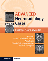 Cover image: Advanced Neuroradiology Cases 9781107088719