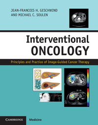 Cover image: Interventional Oncology 2nd edition 9781107043473