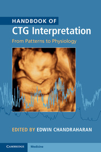 Cover image: Handbook of CTG Interpretation 9781107485501