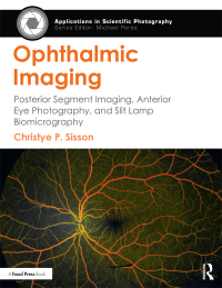 Cover image: Ophthalmic Imaging 1st edition 9781138885998