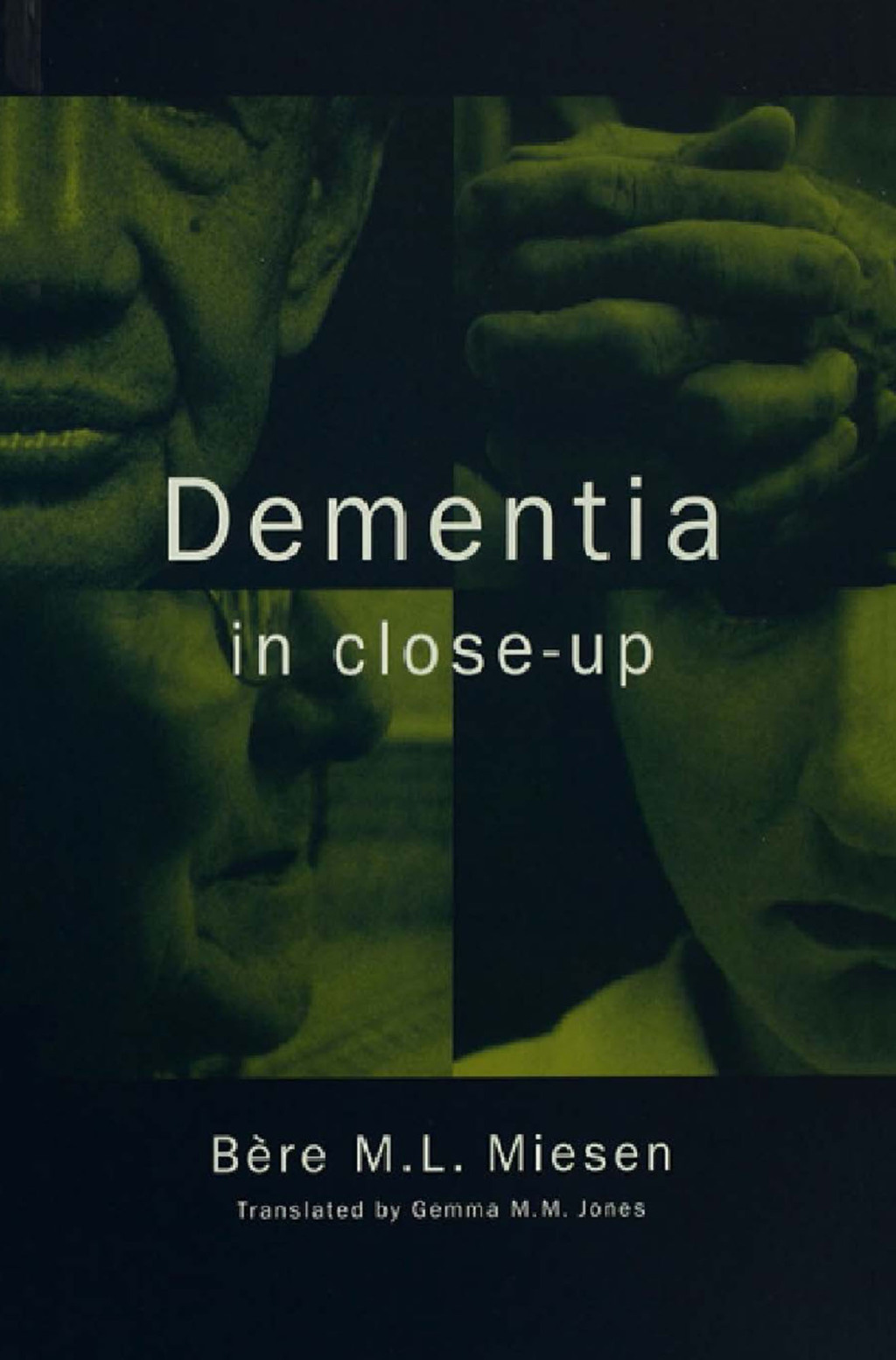 Dementia in Close-Up 1st Edition