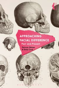 Omslagafbeelding: Approaching Facial Difference 1st edition 9781350028296