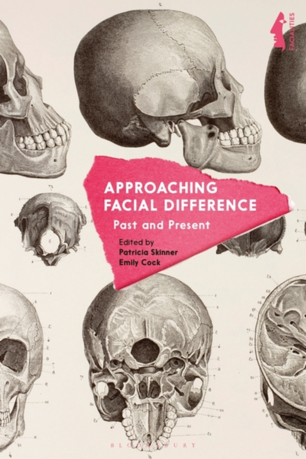 Approaching Facial Difference Past and Present 1st Edition