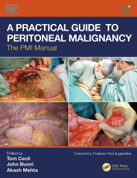 Titelbild: A Practical Guide to Peritoneal Malignancy 1st edition 9781138495050