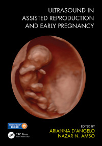 صورة الغلاف: Ultrasound in Assisted Reproduction and Early Pregnancy 1st edition 9781138486171