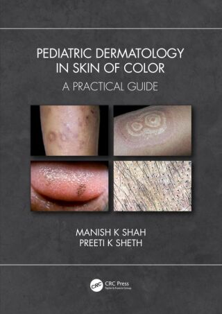 Imagen de portada: Pediatric Dermatology in Skin of Color 1st edition 9781032189468
