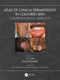 Cover image: Atlas of Clinical Dermatology in Coloured Skin 1st edition 9781032399669