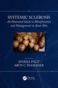 表紙画像: Systemic Sclerosis 1st edition 9780367731403