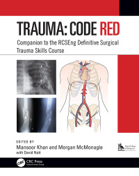 Cover image: Trauma: Code Red 1st edition 9781138477025