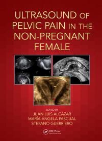 Cover image: Ultrasound of Pelvic Pain in the Non-Pregnant Patient 1st edition 9780815364993