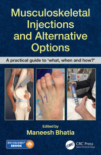 Titelbild: Musculoskeletal Injections and Alternative Options 1st edition 9780815355571