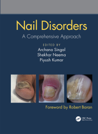 Imagen de portada: Nail Disorders 1st edition 9780815378341