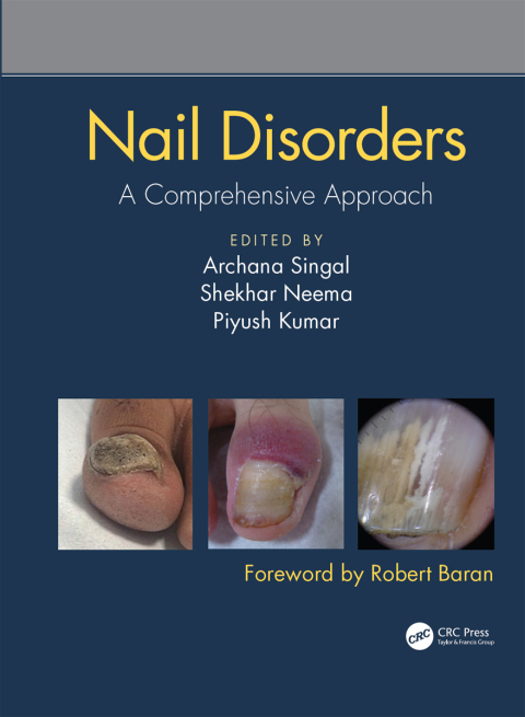 Nail Disorders: A Comprehensive Approach, 1st Edition - FULL INSTANT DOWNLOAD | PDF DOCX EPUB