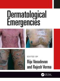 Cover image: Dermatological Emergencies 1st edition 9780367778606