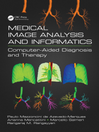 Cover image: Medical Image Analysis and Informatics 1st edition 9780367876289